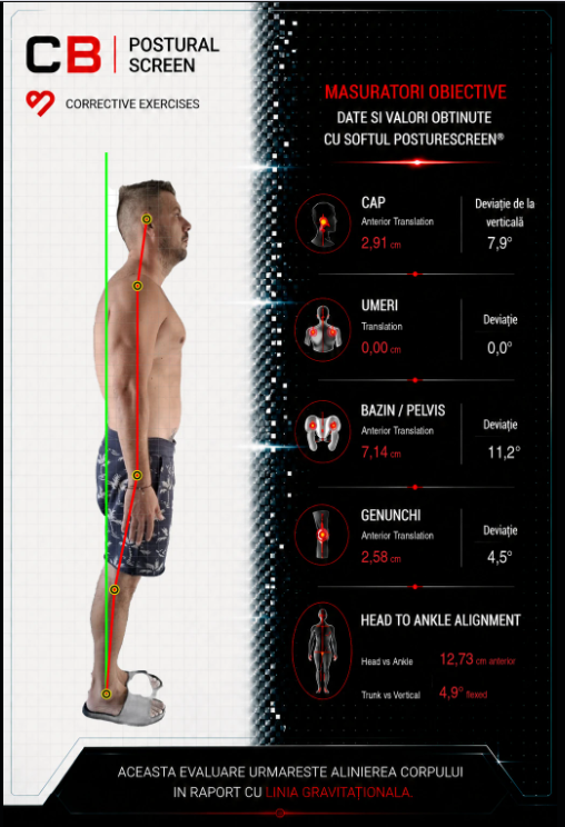 Screening postural CB Performance